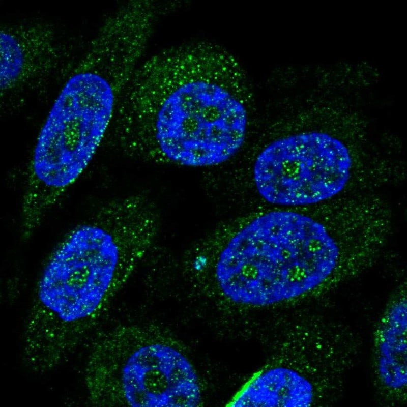 ZNF586 Antibody - BSA Free Immunocytochemistry/ Immunofluorescence: ZNF586 Antibody [NBP2-56434]