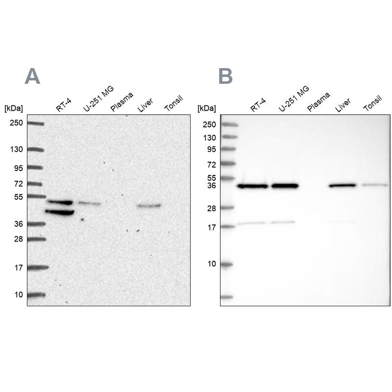 IKIP Antibody Western Blot: IKIP Antibody Antibody [NBP2-56525]
