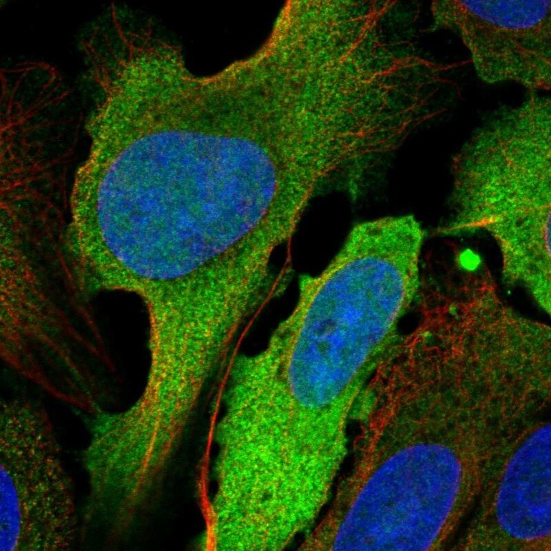 UbcH10/UBE2C Antibody - BSA Free Immunocytochemistry/ Immunofluorescence: UbcH10/UBE2C Antibody [NBP2-56693]