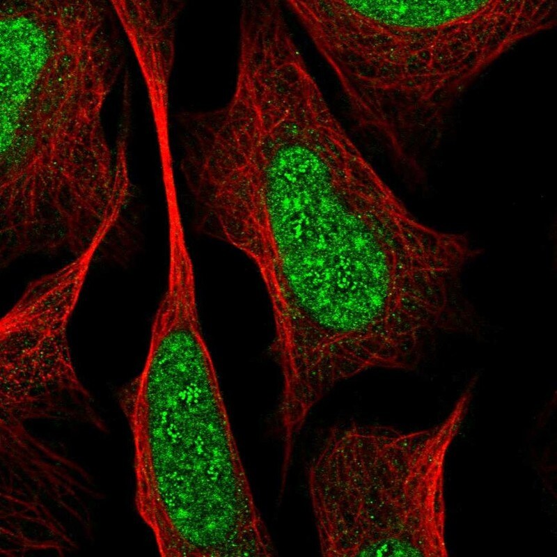 RREB1 Antibody - BSA Free Immunocytochemistry/ Immunofluorescence: RREB1 Antibody - BSA Free [NBP2-56824]