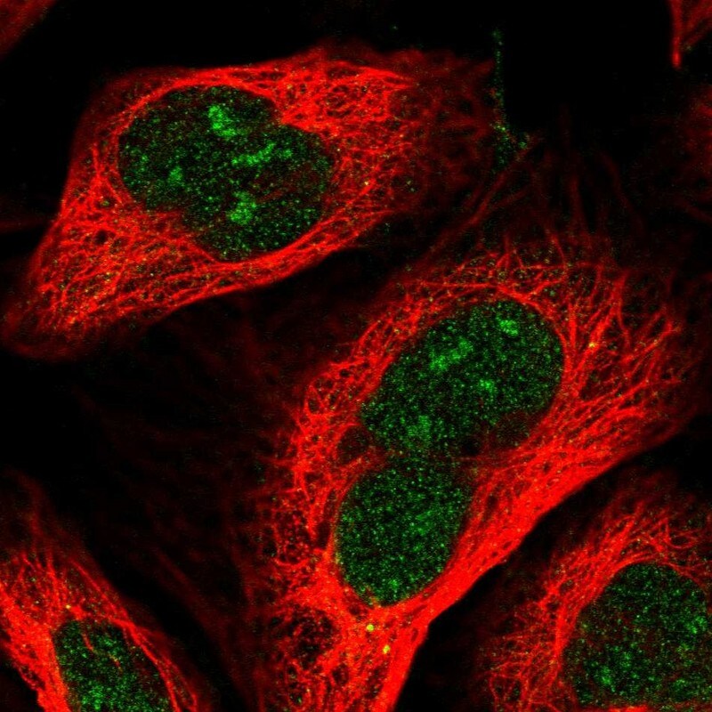 RRP36 Antibody - BSA Free Immunocytochemistry/ Immunofluorescence: RRP36 Antibody - BSA Free [NBP2-56838]