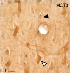 MCT8/SLC16A2 Antibody - BSA Free