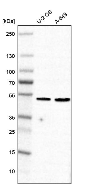MEX3A Antibody - BSA Free Western Blot: MEX3A Antibody - BSA Free [NBP2-57357]