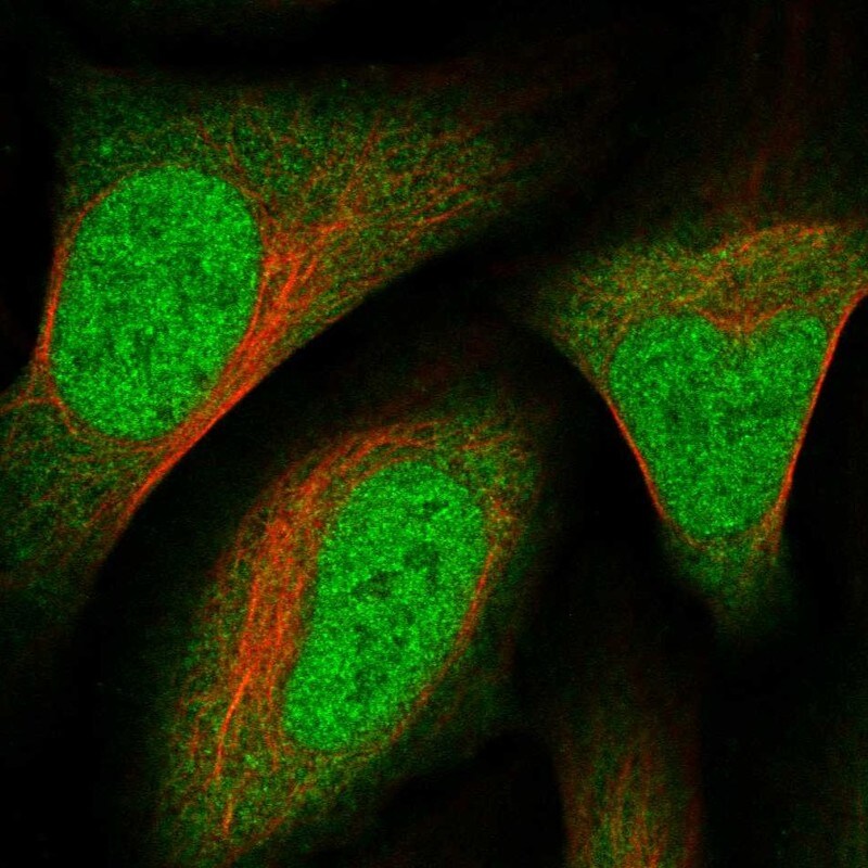 RHBDL1 Antibody - BSA Free Immunocytochemistry/ Immunofluorescence: RHBDL1 Antibody [NBP2-57512]