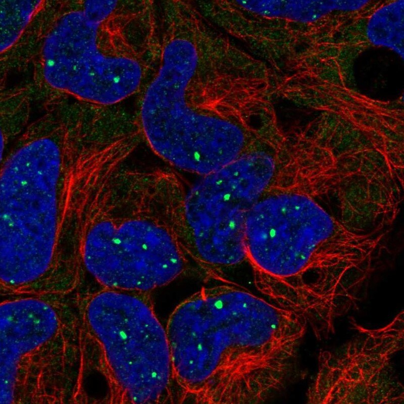 BMI-1 Antibody - BSA Free Immunocytochemistry/ Immunofluorescence: BMI-1 Antibody - BSA Free [NBP2-57552]