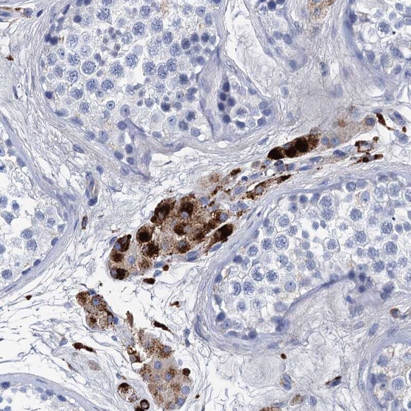 Apolipoprotein D Antibody - BSA Free Immunohistochemistry-Paraffin: Apolipoprotein D Antibody [NBP2-57684]