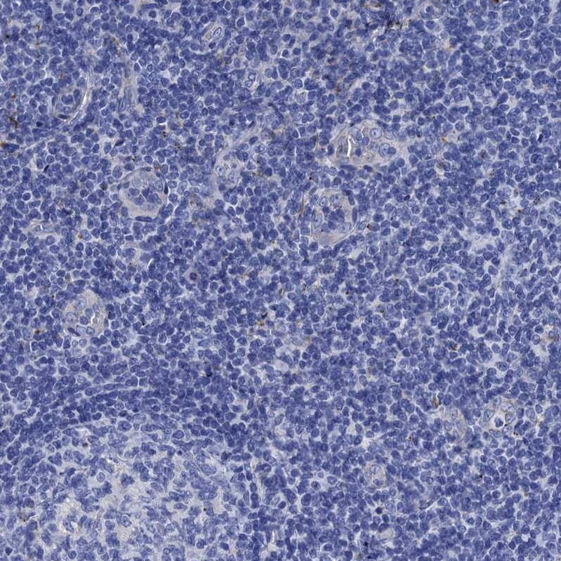 Apolipoprotein D Antibody - BSA Free Immunohistochemistry-Paraffin: Apolipoprotein D Antibody [NBP2-57684]