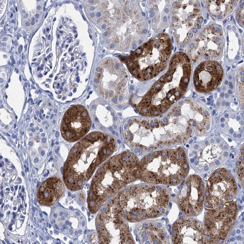 Apolipoprotein D Antibody - BSA Free Immunohistochemistry-Paraffin: Apolipoprotein D Antibody [NBP2-57684]