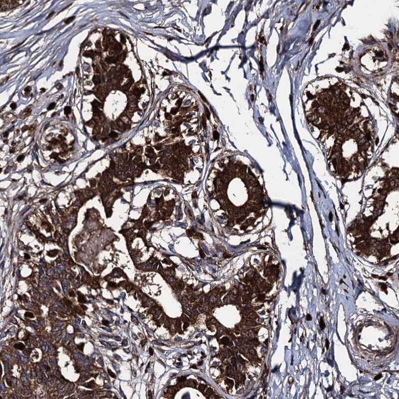 Apolipoprotein D Antibody - BSA Free Immunohistochemistry-Paraffin: Apolipoprotein D Antibody [NBP2-57684]