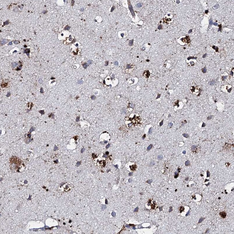 Apolipoprotein D Antibody - BSA Free Immunohistochemistry-Paraffin: Apolipoprotein D Antibody [NBP2-57684]