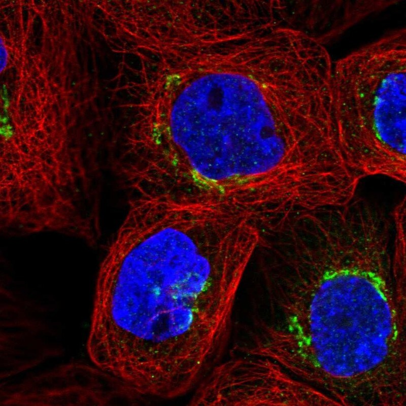 beta-Galactosidase-1/GLB1 Antibody - BSA Free Immunocytochemistry/ Immunofluorescence: beta-Galactosidase-1/GLB1 Antibody - BSA Free [NBP2-57793]