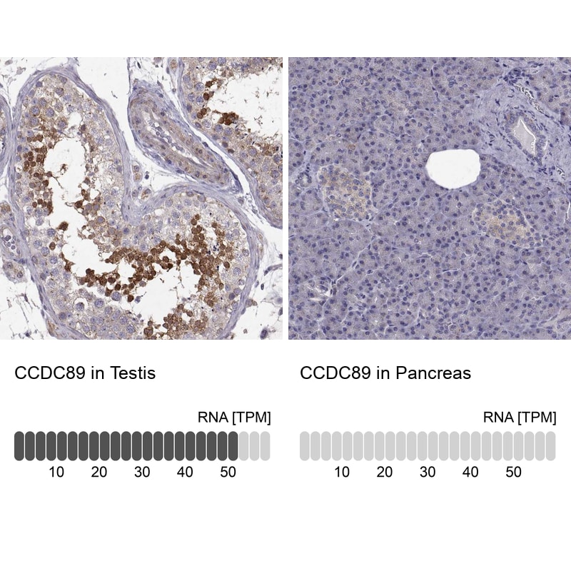 CCDC89 Antibody - BSA Free Immunohistochemistry-Paraffin: CCDC89 Antibody [NBP2-57795]