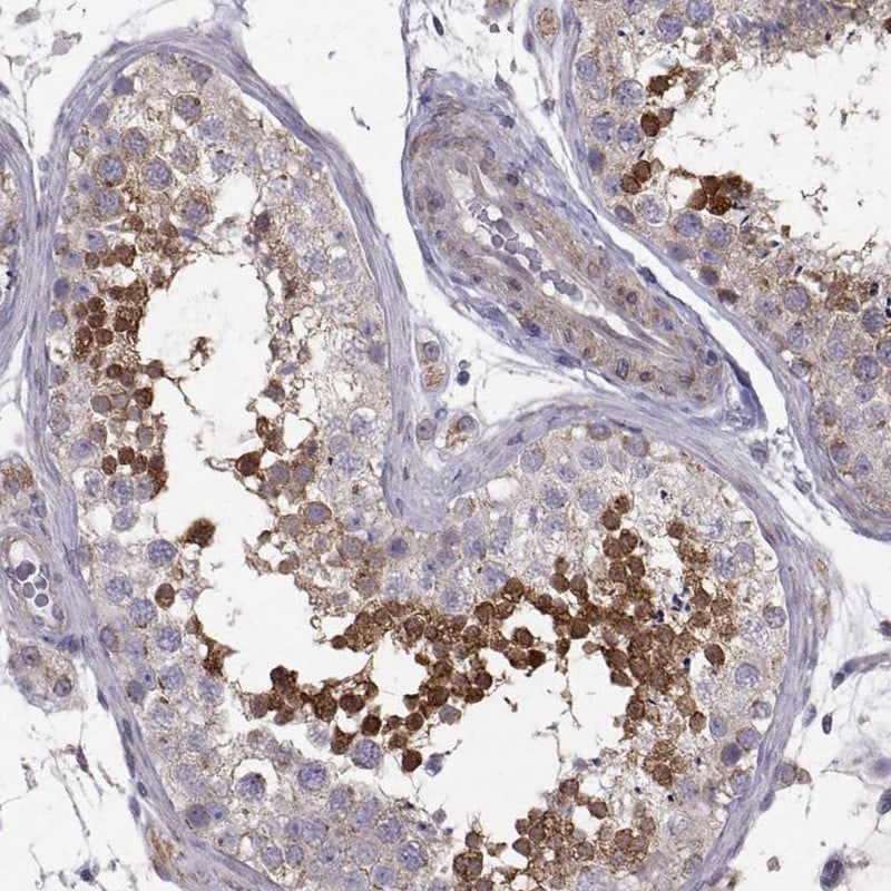 CCDC89 Antibody - BSA Free Immunohistochemistry-Paraffin: CCDC89 Antibody [NBP2-57795]