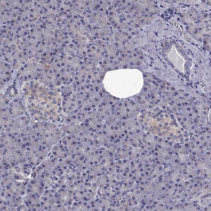 CCDC89 Antibody - BSA Free Immunohistochemistry-Paraffin: CCDC89 Antibody [NBP2-57795]