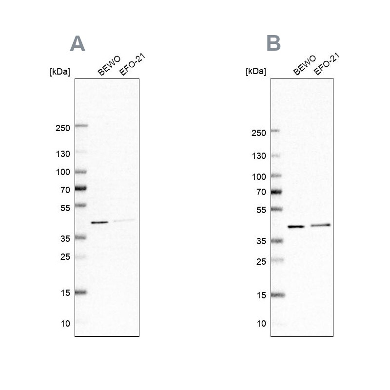 PCBP1 Antibody Western Blot: PCBP1 Antibody Antibody [NBP2-57878]