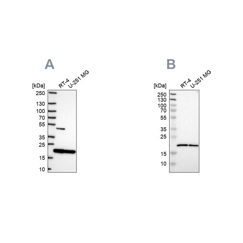 SRI Antibody - BSA Free Western Blot: SRI Antibody - BSA Free [NBP2-57990]