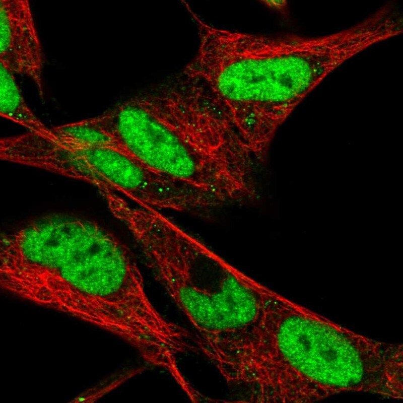 HAND2 Antibody - BSA Free Immunocytochemistry/ Immunofluorescence: HAND2 Antibody [NBP2-58062]