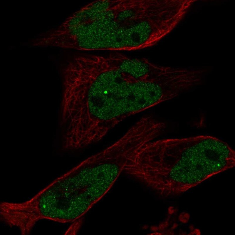 EYA1 Antibody - BSA Free Immunocytochemistry/ Immunofluorescence: EYA1 Antibody [NBP2-58069]
