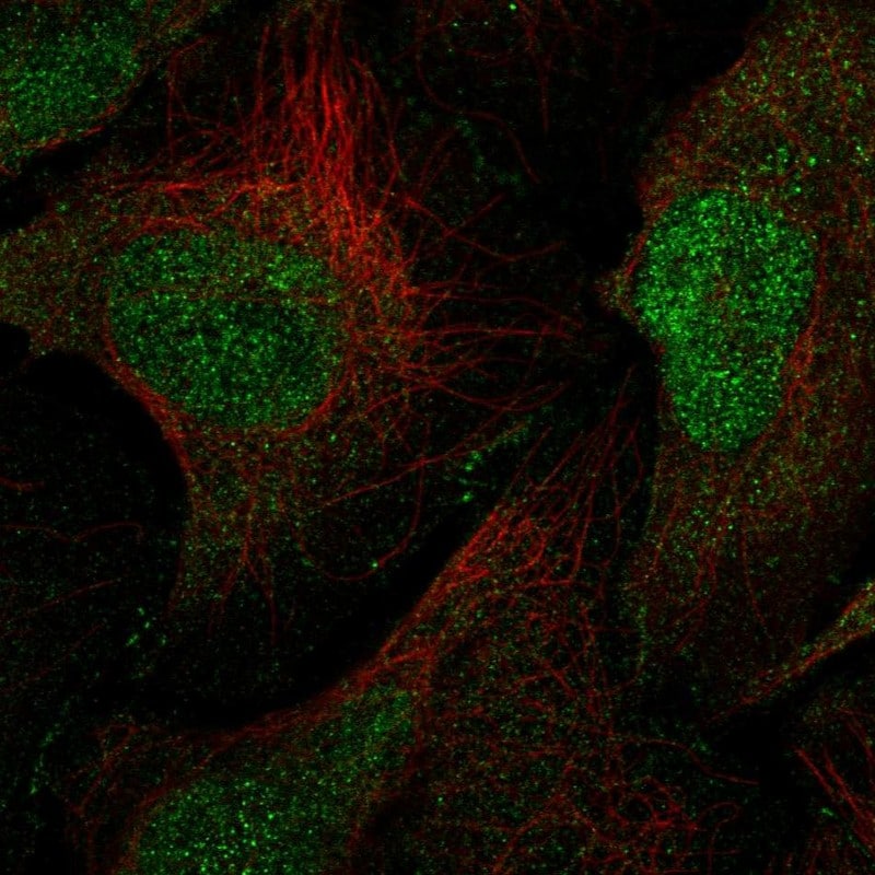 MAGI1 Antibody - BSA Free Immunocytochemistry/ Immunofluorescence: MAGI1 Antibody - BSA Free [NBP2-58071]