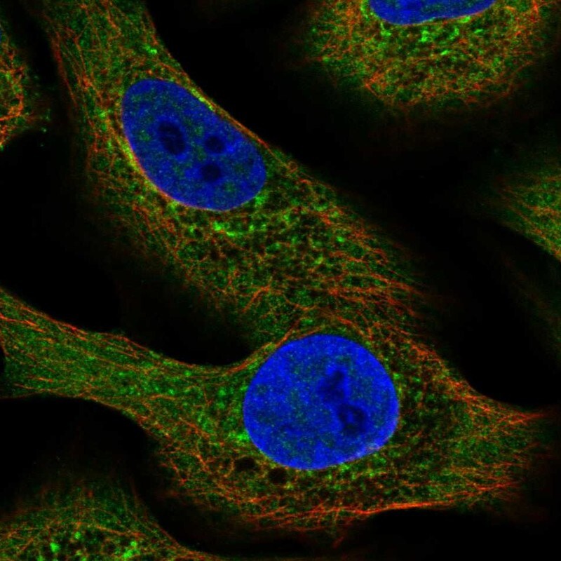 NLRP2/NALP2 Antibody - BSA Free Immunocytochemistry/ Immunofluorescence: NLRP2/NALP2 Antibody [NBP2-58146]