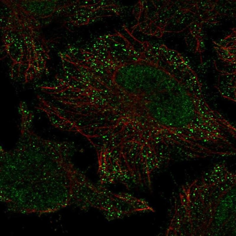 PIEZO2 Antibody - BSA Free Immunocytochemistry/ Immunofluorescence: PIEZO2 Antibody - BSA Free [NBP2-58161]