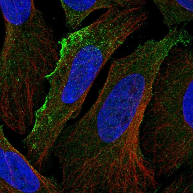 CXCR7/RDC-1 Antibody - BSA Free Immunocytochemistry/ Immunofluorescence: CXCR7/RDC-1 Antibody [NBP2-58162]
