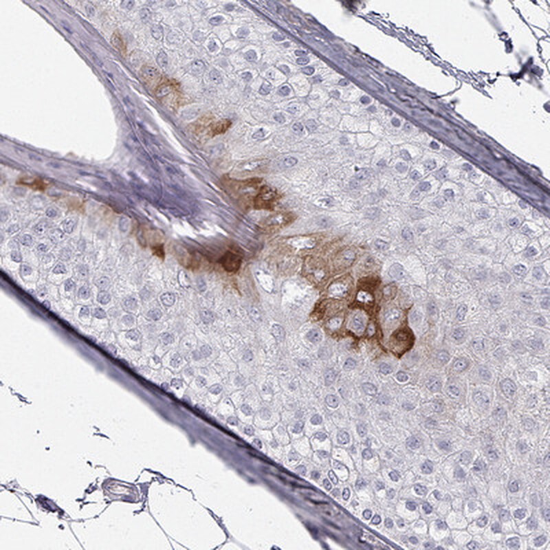 KRT84 Antibody - BSA Free Immunohistochemistry: KRT84 Antibody - BSA Free [NBP2-58176]