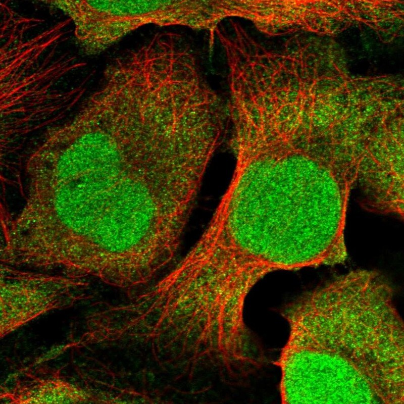 CDT2 Antibody - BSA Free Immunocytochemistry/ Immunofluorescence: CDT2 Antibody - BSA Free [NBP2-58216]