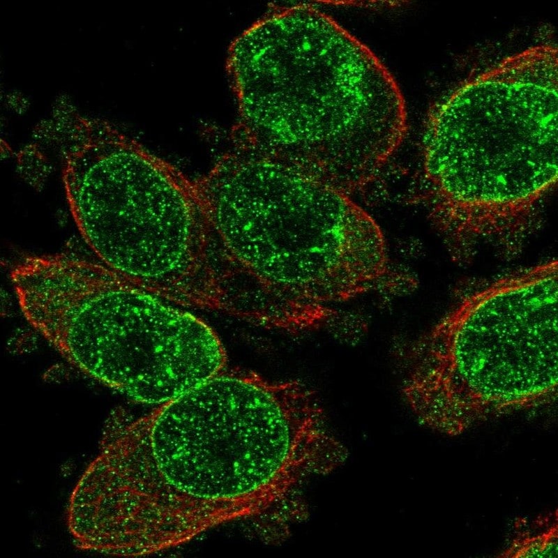 TRPM2 Antibody - BSA Free Immunocytochemistry/ Immunofluorescence: TRPM2 Antibody - BSA Free [NBP2-58306]