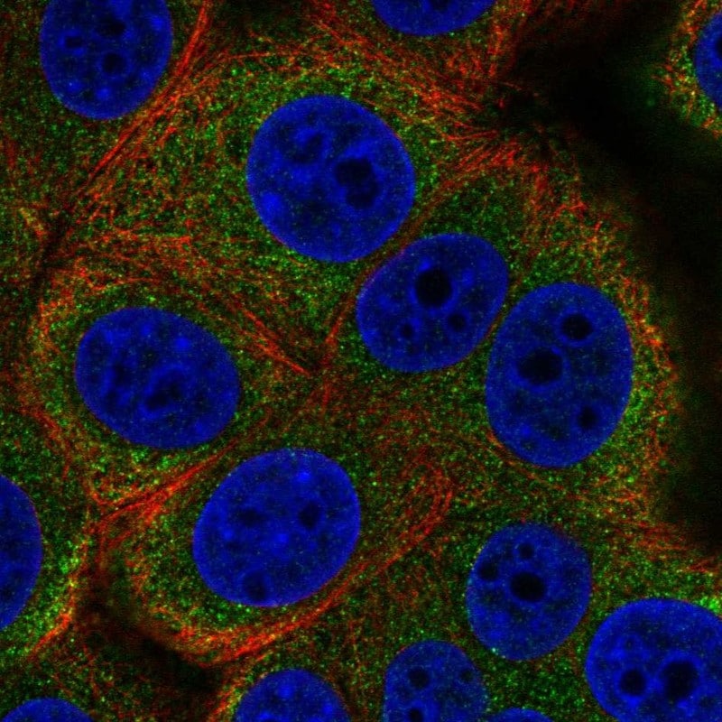 ALG12 Antibody - BSA Free Immunocytochemistry/ Immunofluorescence: ALG12 Antibody - BSA Free [NBP2-58353]