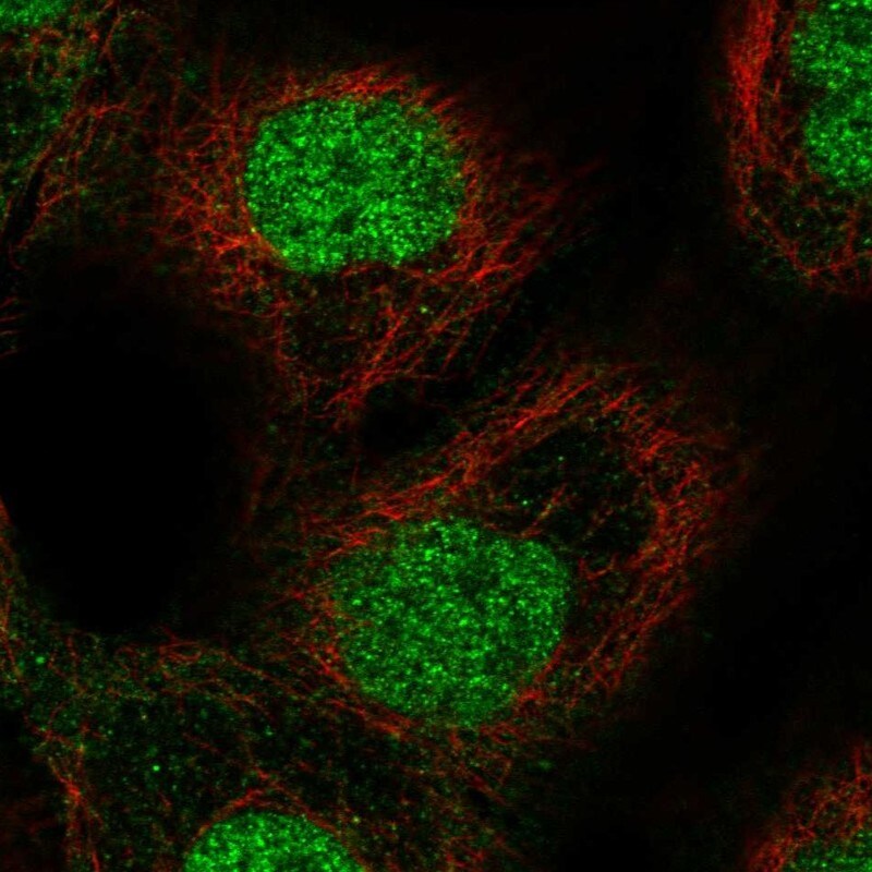 ETS2 Antibody - BSA Free Immunocytochemistry/ Immunofluorescence: ETS2 Antibody [NBP2-58355]