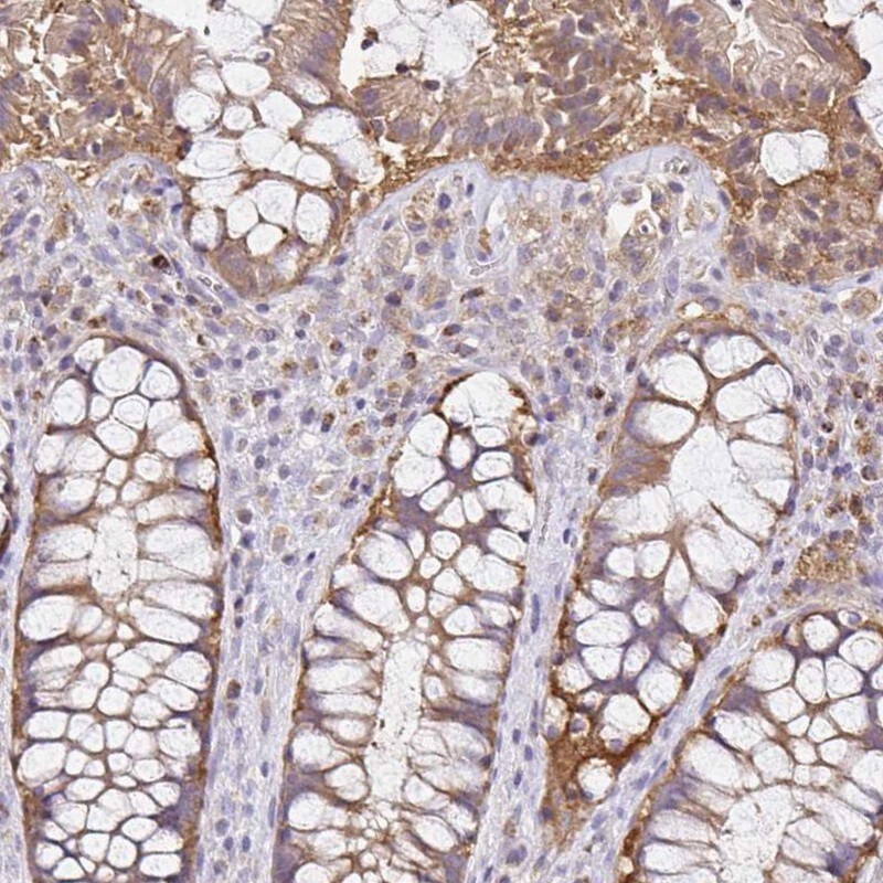 NAD Synthetase Antibody - BSA Free Immunohistochemistry-Paraffin: NAD Synthetase Antibody [NBP2-58372]