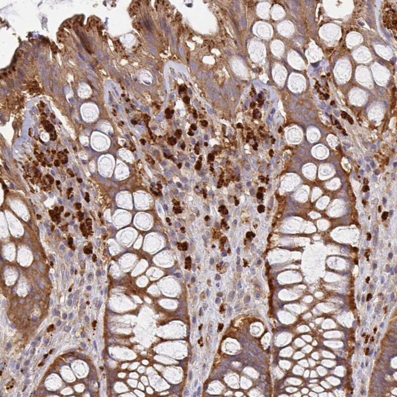 NAD Synthetase Antibody - BSA Free Immunohistochemistry-Paraffin: NAD Synthetase Antibody [NBP2-58373]