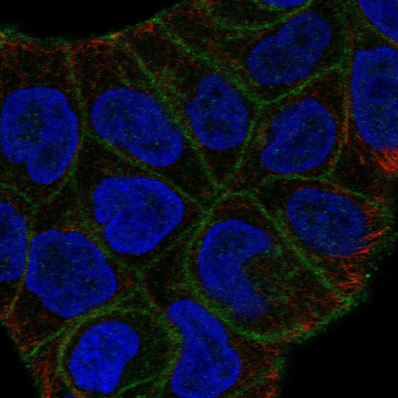 SLITRK6 Antibody - BSA Free Immunocytochemistry/ Immunofluorescence: SLITRK6 Antibody - BSA Free [NBP2-58375]