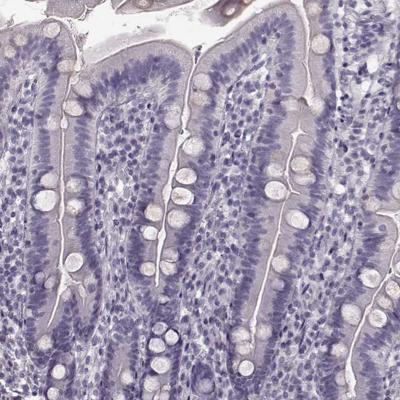 TRPM1 Antibody - BSA Free Immunohistochemistry: TRPM1 Antibody - BSA Free [NBP2-58415]