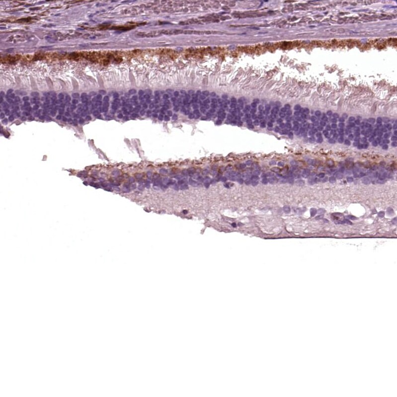 TRPM1 Antibody - BSA Free Immunohistochemistry: TRPM1 Antibody - BSA Free [NBP2-58415]
