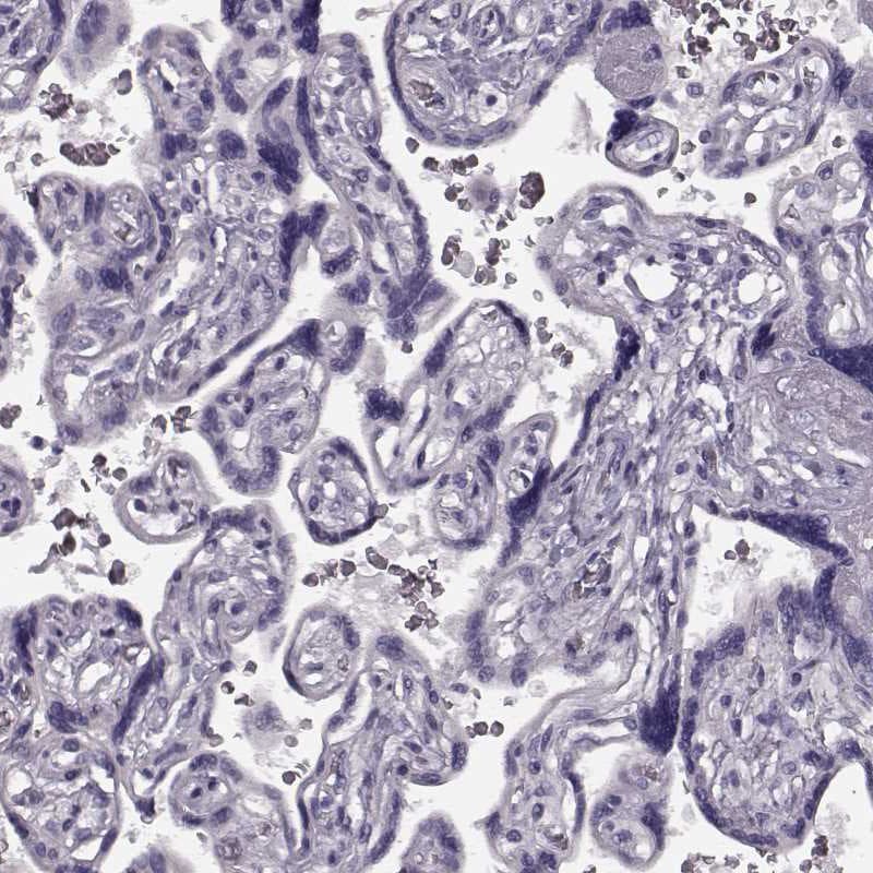 TRPM1 Antibody - BSA Free Immunohistochemistry: TRPM1 Antibody - BSA Free [NBP2-58415]