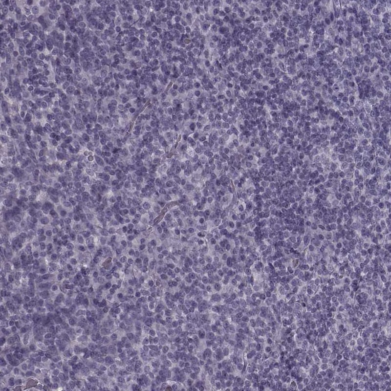 TRPM1 Antibody - BSA Free Immunohistochemistry: TRPM1 Antibody - BSA Free [NBP2-58415]