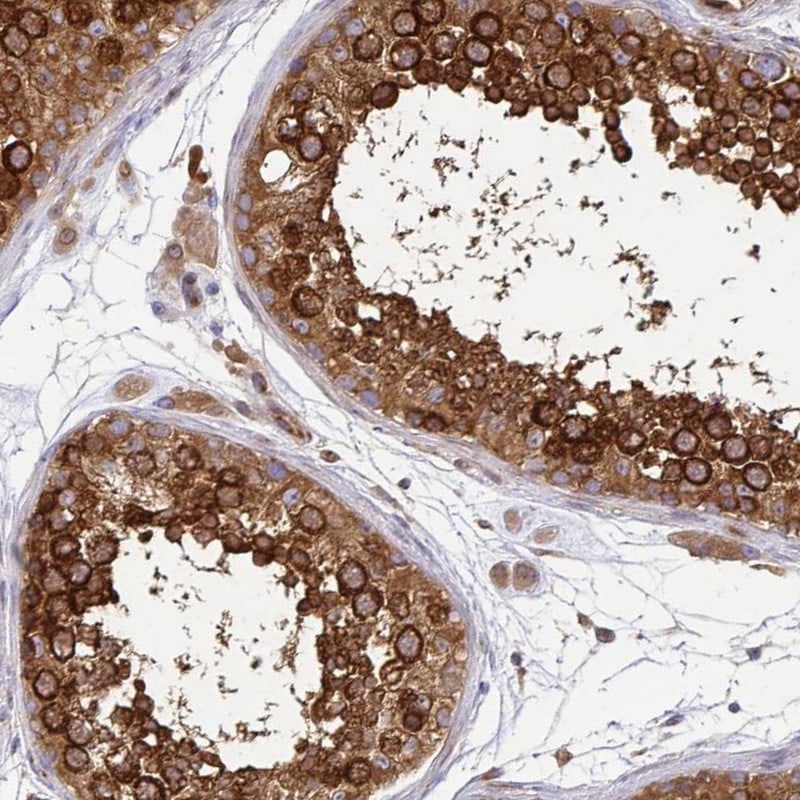 Kinesin 5B Antibody - BSA Free Immunohistochemistry-Paraffin: Kinesin 5B Antibody [NBP2-58451]