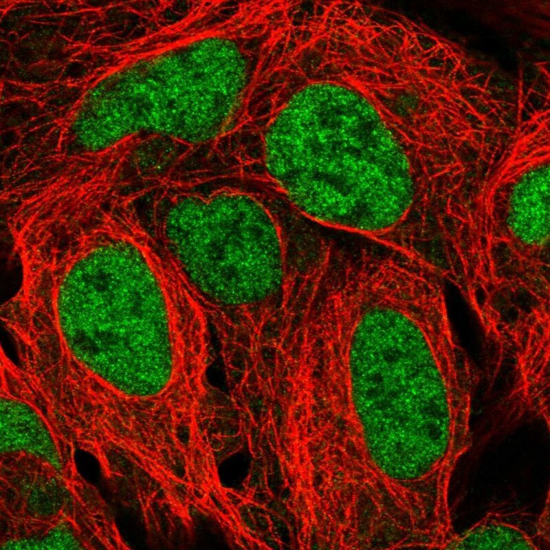 TAF11 Antibody - BSA Free Immunocytochemistry/ Immunofluorescence: TAF11 Antibody [NBP2-58561]