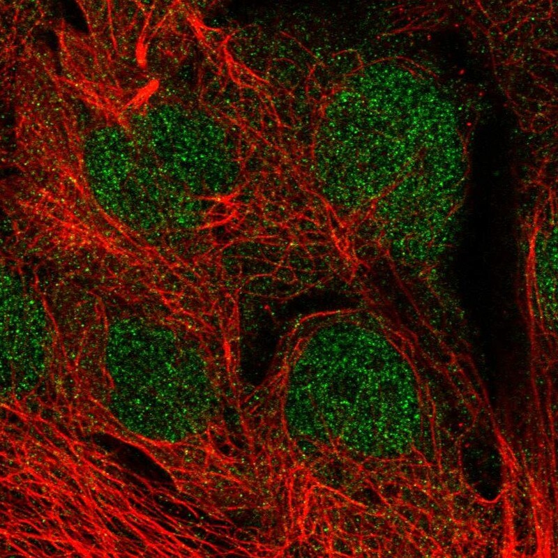 MGMT Antibody - BSA Free Immunocytochemistry/ Immunofluorescence: MGMT Antibody - BSA Free [NBP2-58611]