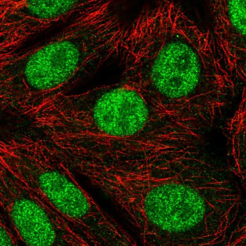 RNF220 Antibody - BSA Free Immunocytochemistry/ Immunofluorescence: RNF220 Antibody [NBP2-58631]