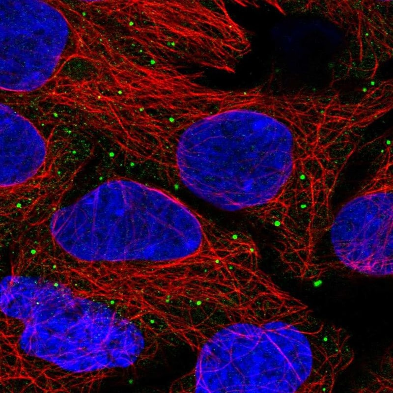 ANKRD6 Antibody - BSA Free Immunocytochemistry/ Immunofluorescence: ANKRD6 Antibody - BSA Free [NBP2-58634]