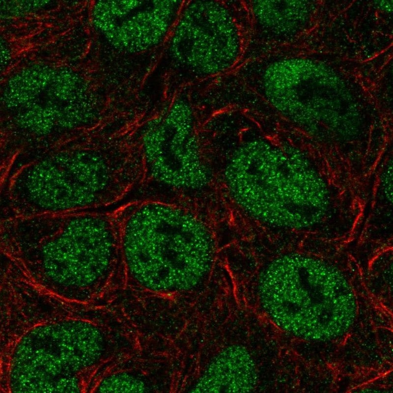 TRERF1 Antibody - BSA Free Immunocytochemistry/ Immunofluorescence: TRERF1 Antibody - BSA Free [NBP2-58666]