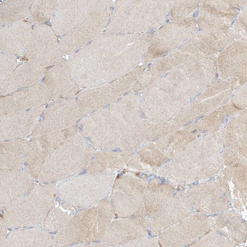 PGD Antibody - BSA Free Immunohistochemistry-Paraffin: PGD Antibody [NBP2-58686]