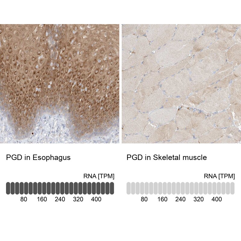 PGD Antibody - BSA Free Immunohistochemistry-Paraffin: PGD Antibody [NBP2-58686]