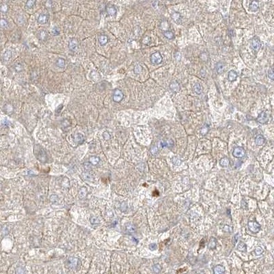 PGD Antibody - BSA Free Immunohistochemistry-Paraffin: PGD Antibody [NBP2-58686]