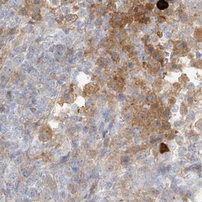 PGD Antibody - BSA Free Immunohistochemistry-Paraffin: PGD Antibody [NBP2-58686]