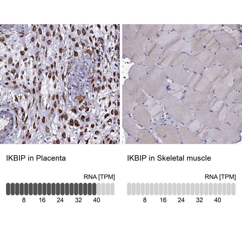 IKIP Antibody - BSA Free Immunohistochemistry-Paraffin: IKIP Antibody [NBP2-58695]