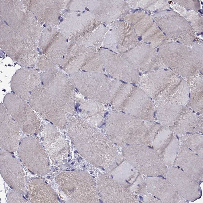 IKIP Antibody - BSA Free Immunohistochemistry-Paraffin: IKIP Antibody [NBP2-58695]